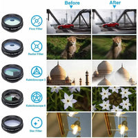 10in1 Phone Lens Kit
