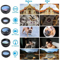 10in1 Phone Lens Kit